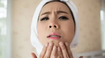 أفضل علاج موضعي لحب الشباب