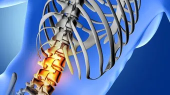 أفضل علاج لوجع الظهر