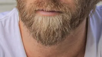 أفضل علاج لشيب اللحية