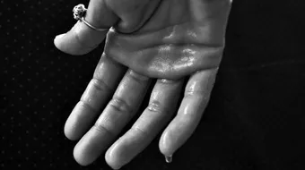 أفضل علاج لتعرق اليدين