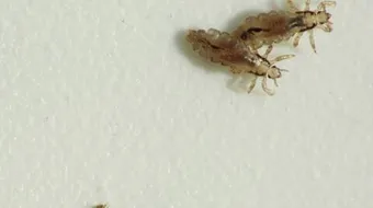 أفضل طريقة للقضاء على القمل