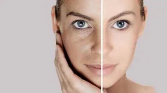 أفضل طريقة لعلاج حفر الوجه