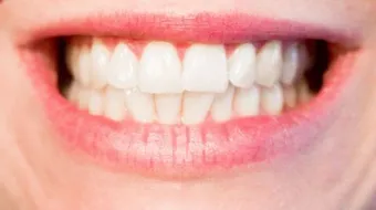 أفضل الطرق للتخلص من رائحة الفم