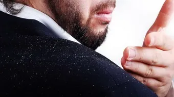 أسباب قشرة الشعر وعلاجها
