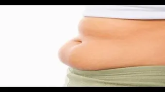 أسباب الكرش عند البنات