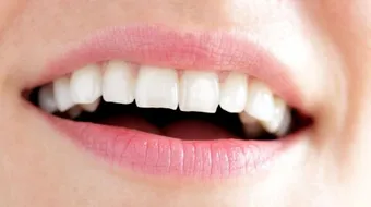 اسهل طريقة لتبييض الاسنان