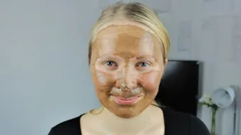 آثار حب الشباب وعلاجها السريع