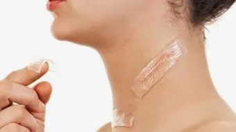 آثار الحروق القديمة