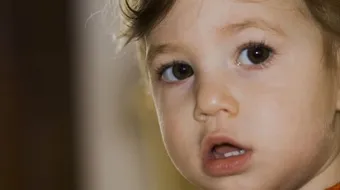 آثار ظهور الاسنان عند الأطفال