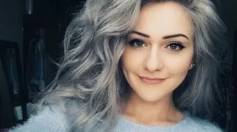 ظهور الشعر الأبيض في سن العشرين