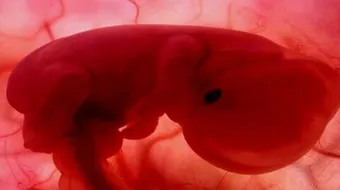 مراحل الحمل الأولى