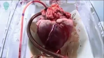 قلب الإنسان وكيف يعمل