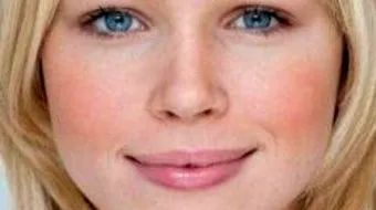 طريقة تسمين الوجه بسرعة