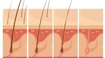 اسم سطح الطبقة الداخلية للجلد