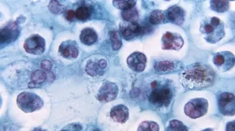 اسم كريات الدم البيضاء