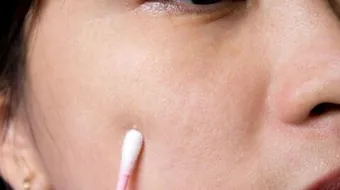 سبب ظهور الحبوب البيضاء في الوجه