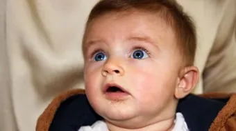 سبب تأخر ظهور الأسنان عند الرضع