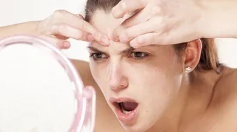 أسباب ظهور حبوب صغيرة في الوجه