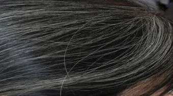 أسباب ظهور الشعر الأبيض