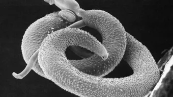 طريقة انتشار البلهارسيا