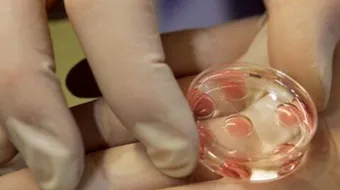 مراحل عملية طفل الأنابيب