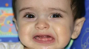 مراحل نمو الأسنان عند الأطفال