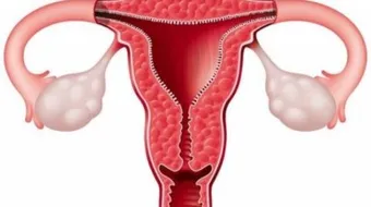 سمك بطانة الرحم