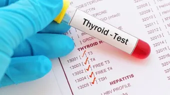 تحليل الغدة الدرقية tsh