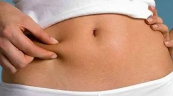 شد البطن المترهل