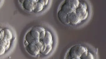 نصائح بعد ترجيع الأجنة