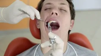 طريقة خلع السن