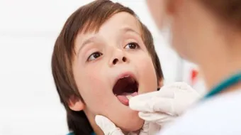 علاج بحة الصوت بسرعة