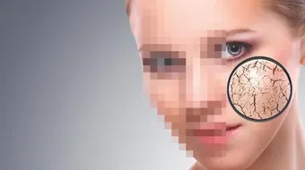 علاج جفاف وتقشر البشرة