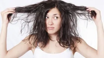 علاج جفاف الشعر