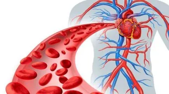 علاج انسداد عروق القلب