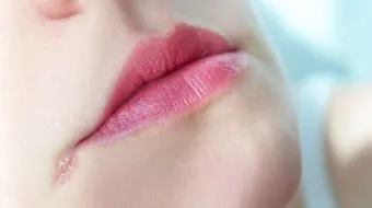 علاج فطريات الشفاه