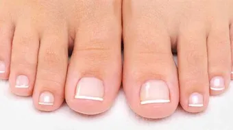 علاج فطريات الظفر