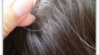 علاج شيب الشعر المبكر