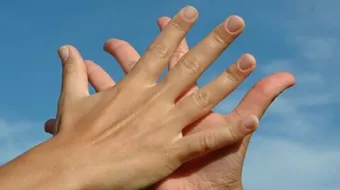 علاج تعرق اليدين بالشاي