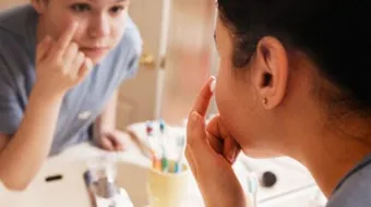 علاج آثار حب الشباب