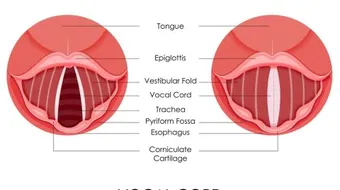 علاج تشقق اللسان
