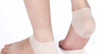 علاج تشققات كعب القدم