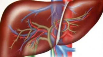 علاج تضخم الكبد