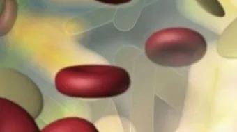 علاج ارتفاع كريات الدم البيضاء