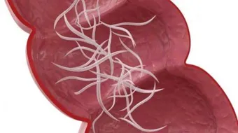 علاج ديدان البطن عند الكبار