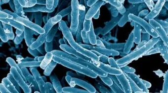 مرض الدرن وطرق الوقاية منه