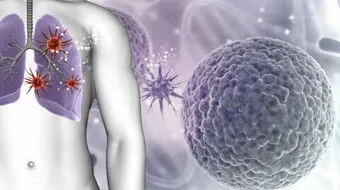 طرق انتقال الدرن