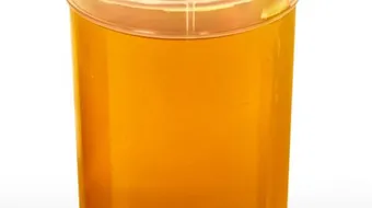 أنواع الزلال