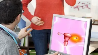 أنواع الأكياس على المبيض