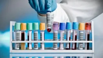 أنواع التحاليل الطبية